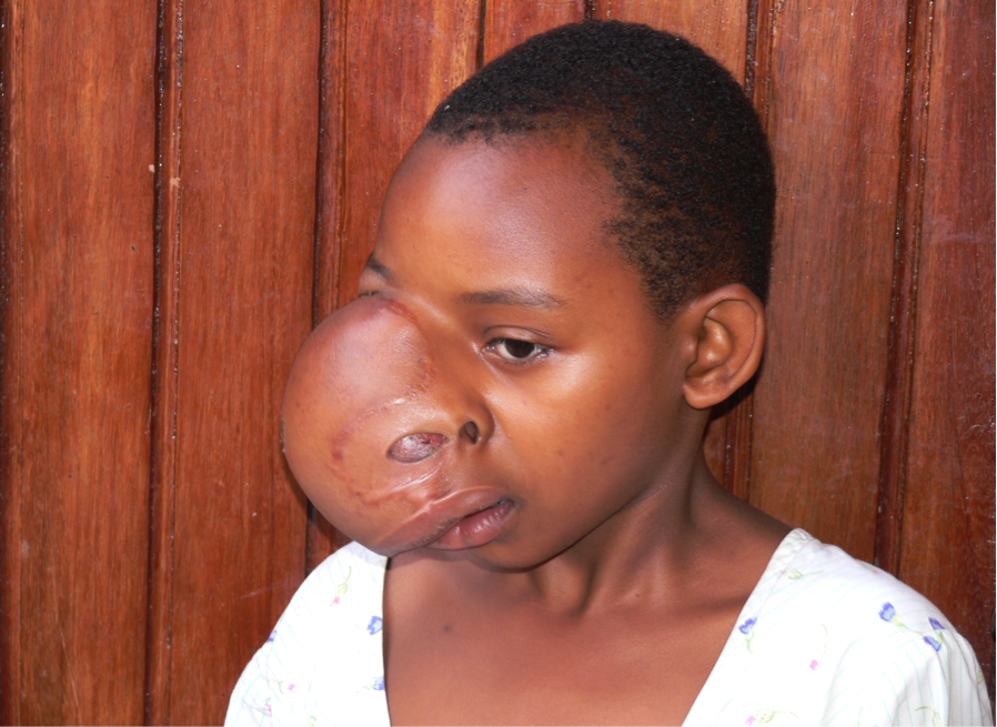 Cancer Africa – About Us
